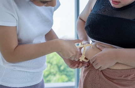 Healthcare professional using skinfold calipers to measure abdominal body fat on a patient